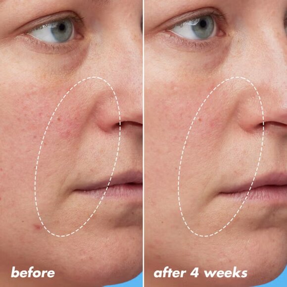 Youth Boosting Blue-ty Sleep Night Oil - Picture 2 of 7